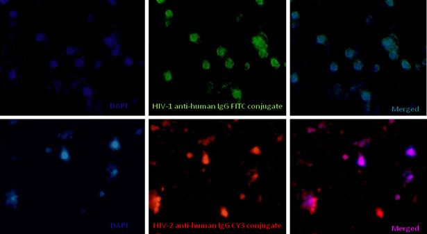 Indirect Immunofluorescence: HIV-1&2 Dual Infections
