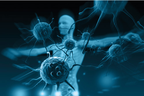 Combined Gene Therapy of Cancer Directed at Tumor Stem Cells and Patients Hematopoietic Stem Cells