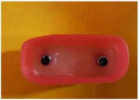Comparative Evaluation of Vertical Microgaps and Torque Loss in Two Ball-Attachment-Systems of Mandibular Implant-Retained-Overdentures