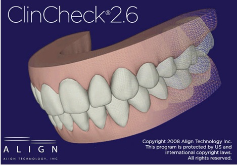 Aesthetic Removable Orthodontic Alternative- Invisalign