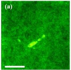Two-Photon Microscopy to Visualize Amyloid-Beta Plaques in Retinas from Alzheimerâ€™s Disease