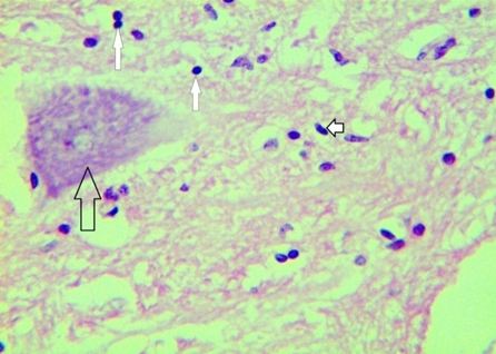 Pathological Changes in the Nervous System of Horse Naturally Affected By Dourine in Arsi-Bale Highlands, Ethiopia