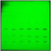 Simultaneous Estimation of Chlorzoxazone Paracetamol Famotidine and Diclofenac Potassium in Their Combined Dosage Form by Thin Layer Chromatography