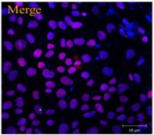 Simple Isolation of Pancreatic Progenitor Cells from Human Induced Pluripotent Stem Cells Using the ALDEFLUOR