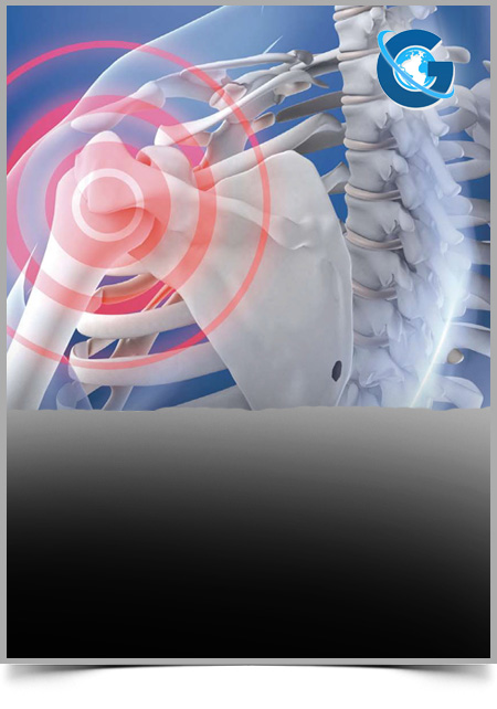 Cancer cachexia and the effects of physical activity