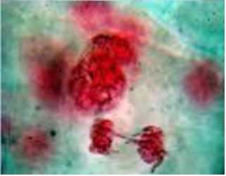 Cytogenetic Studies on Allium Cepa L in Response to Green Synthesis Silver Nanoparticales