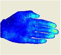 Short Term Sensory and Cutaneous Vascular Responses to Hand Exercise