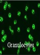 Re-Evaluating the Current ANCA Screening Method: Multiplex Indirect Immunofluorescence Assay in ANCA Testing