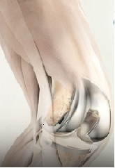 American Physician Assistants in Orthopedic Surgery