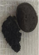 Foreign Body Ingestion in Child: Impaction of Lithium Battery in Gastrointestinal Tract for An Extended Period of Time