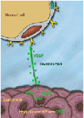 Resection of the Primary Tumor in Asymptomatic or Minimally Symptomatic Patients with Stage IV Colorectal Cancer and Unresectable Metastases