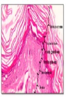 Photobiomodulation Therapy in Diabetic Wound Healing: Review