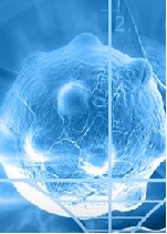 Thymoma: A Review of Research Progression