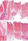 Histological Effects of Enamel Matrix Derivative Proteins (Emdogain®) on the Healing of Rats Wounds