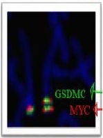 Chromosomal Structural Rearrangements: Characterizing Interstitial Deletions and Duplications in The Clinical Practice