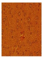 Effect of Lavandula officinalisHydro Alcoholic Extract on Liver Enzymes and Histology