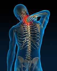 Efficacy of Myofascial Release Method on Pain in Patients with Cervical Radiculopathy Associated with Myofascial Pain