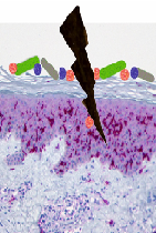 The Crowning with Thorns: How an Intact Skin Forms the First Line of Defense Against Infections                                           