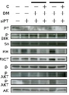 PTEN Suppression on RHEB Expression through Inhibition of mTORC1/S6K1-Dependent Protein Translation in Prostate Cancer Cells