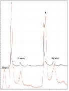 Future Laboratory Medicine: Rapid, Efficient and Affordable Screening for Haemoglobinopathies by MALDI-ToF Mass Spectrometry