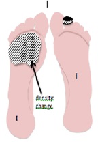 A Study of Plantar Keratoma Using a Classification Model for Student Observational Skills Compared to an Expert Panel