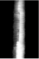 Lift Cycle-Based Decision Support Solution Plan for Pipeline Integrity Management