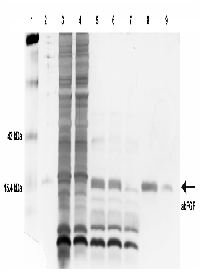Purification of Authentic Human Basic Fibroblast Growth Factor Expressed in Both the Cytoplasm and Culture Medium of Escherichia coli