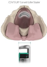 Clinical Experience with the Use of the Contour Curved Cutter Stapler in Colorectal Surgical Procedures: A Systematic Literature Review