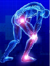 Cuff Tear Arthropathy Following Non-Operative Treatment of Massive Rotator Cuff Tears - a Long Term Study