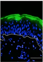 Topical Application of Yolk Lecithin Liposomes Reinforces Skin Barrier Function Against Chemical Agents Such as Psoriasis-inducing IMQ and Alleviates Disease Phenotype