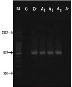 High Frequency of Beta-Lactam Resistance Among Staphylococcus au- reus Isolated from Bovine Mastitis in Northeast of Brazil
