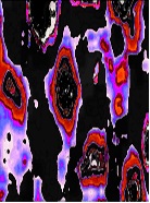 Digital Optical Biopsy of the Pigment Epithelium of Retina