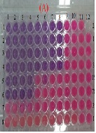Extraction, Isolation and Chemical Modification of the Anacardic Acids from Cashew Nut Shell (Anacardium occidentale L.) and Biological Assay