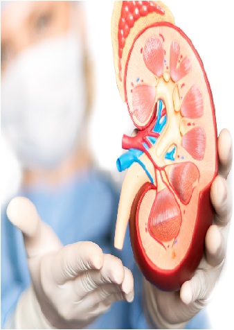 Outcomes of Prenatally Diagnosed Moderate to Severe Hydronephrosis at a Single Institution