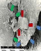 Biomineralogical Phenomenon of Mineralization (Calcification) of Arteries
