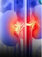 Investigation of the Risk factors of Vascular Calcification in Maintenance Hemodialysis