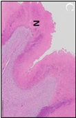 Gastric Ulcer Model in Mini-Pig