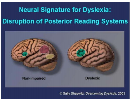 Reading Disability: Current Practices for Learning