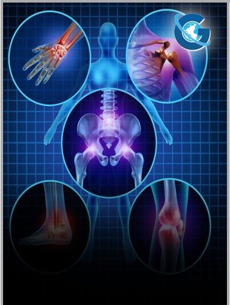 Our Conception About Possibilities of Distraction Osteogenesis Stimulation in Limb Lengthening
