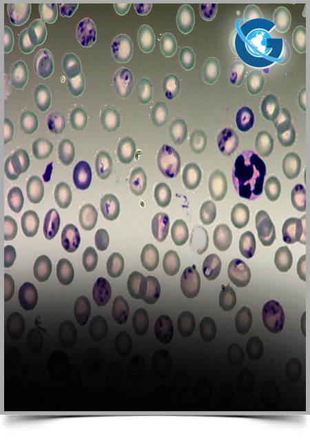 Cat Scratch Disease: An Emerging Bacterial Zoonosis of Public Health Significance