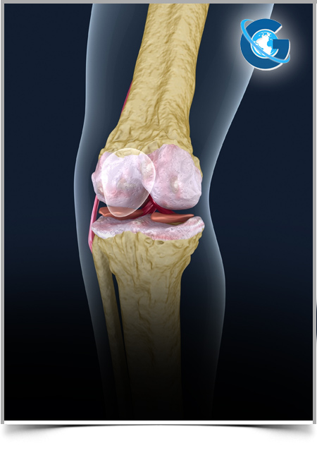 Implementation of A Fracture Liaison Service: An Effective Initiative to Improve Healthcare after Osteoporotic Hip or Wrist Fracture