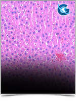 Possible Therapeutic Role of Fermented Deglycyrrhizinizated Liquorice Extract on Experimentally Induced Diabetic  Keratopathy in Rats. Histological Study