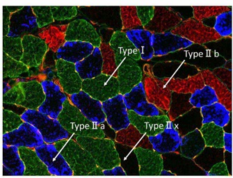 Long-Term Effects of ACL Transection on the Gastrocnemius Muscle in Rats
