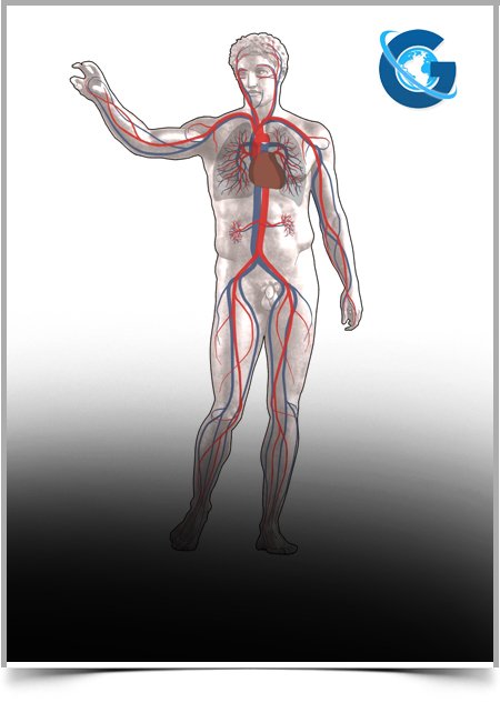 Intravascular Leiomyomatosis: A Case Report and Review of the Literature