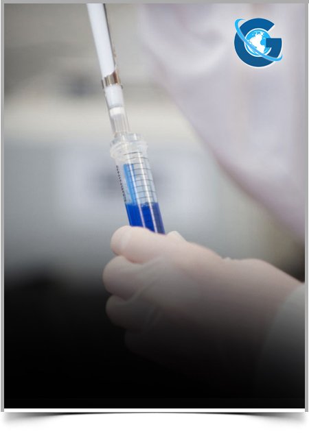 Overview of Anaerobic Digestion and Power and Gas to Grid Plant CAPEX and OPEX Costs