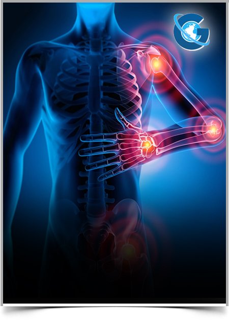 A Pharmacoepidemiologic Study on Rheumatoid Arthritis Patients Attending Outpatient Department at a Tertiary Care Hospital in Bangladesh