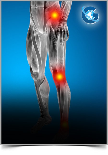 Best Practice use of Wearable Accelerometers in Gait Biomechanics