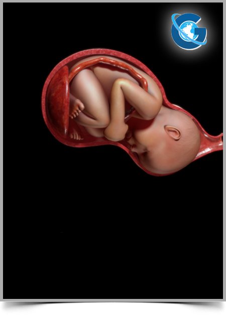 Six Critically Ill COVID-19 Pregnant Patients at a Detroit Hospital: A Case Series