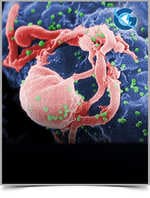 The Transition to Dolutegravir-Based Regimens in the Presence of High- Level Drug Resistance to Nucleotide Reverse Transcriptase Inhibitors: Does It Deserve More Attention?