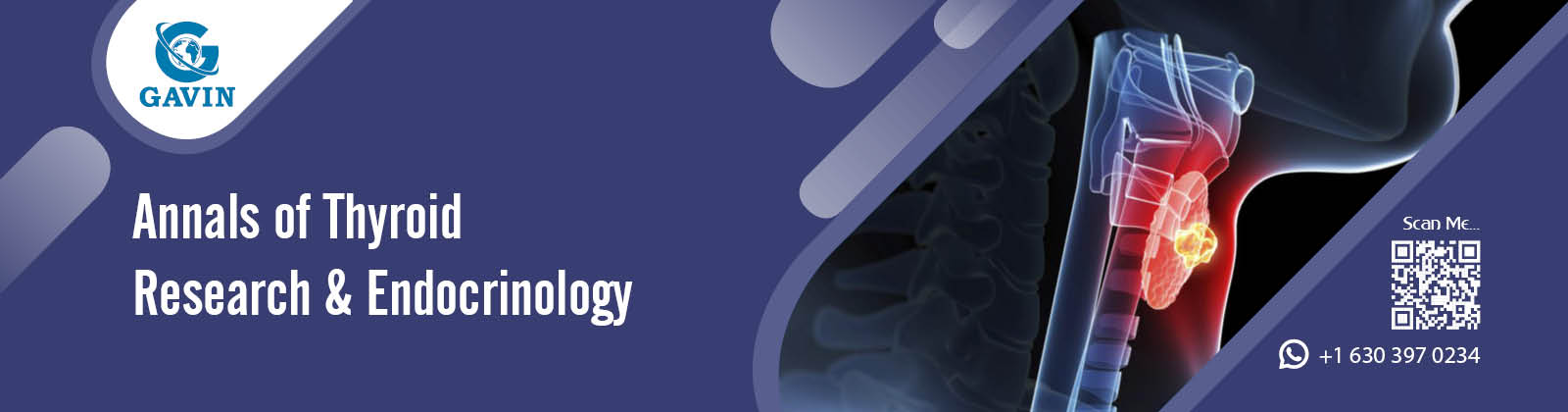Annals of Thyroid Research & Endocrinology